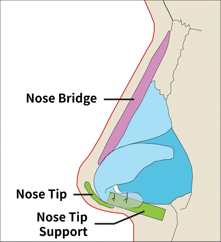 standard rhinoplasty korea